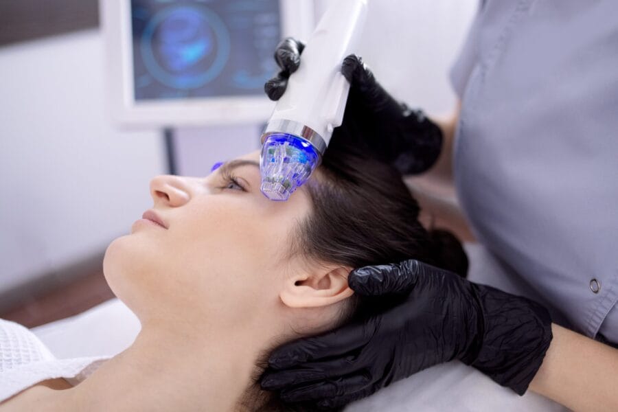 Rf-microneedling